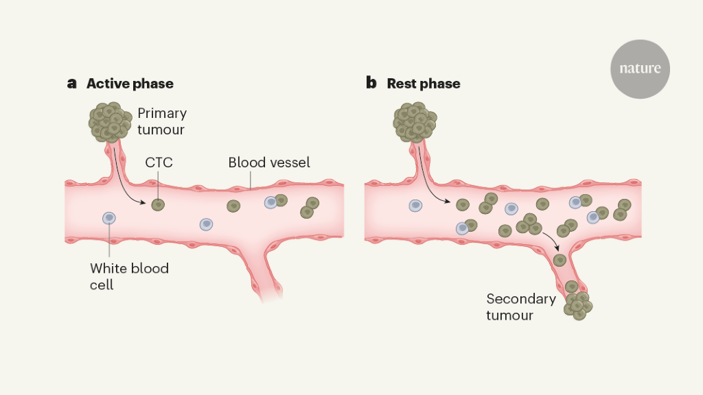 Cancer cells spread aggressively during sleep
