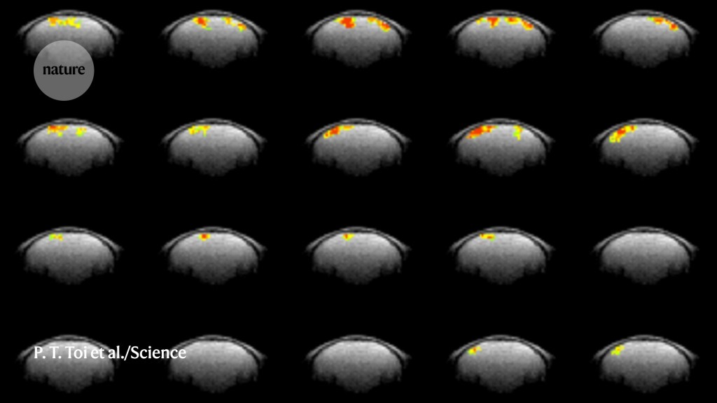 Faster MRI scan captures brain activity in mice