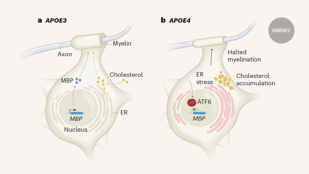 Alzheimer’s risk variant APOE4 linked to myelin-assembly malfunction