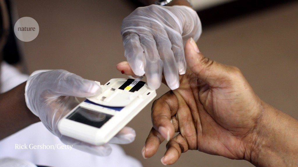 ‘Good’ cholesterol readings can lead to bad results for Black people