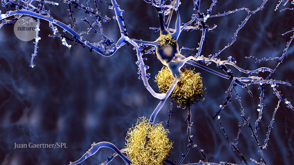 FDA approves Alzheimer’s drug lecanemab amid safety concerns