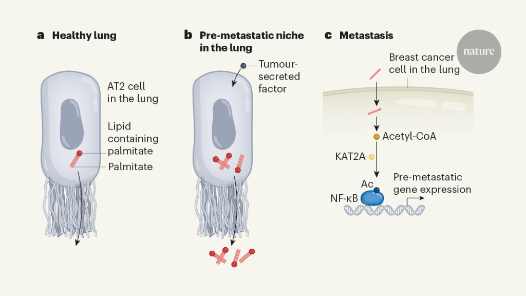 Fatty acids prime the lung as a site for tumour spread