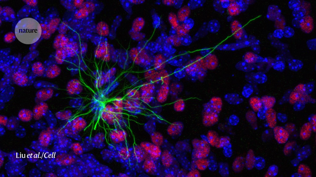 How stem cells make a human brain