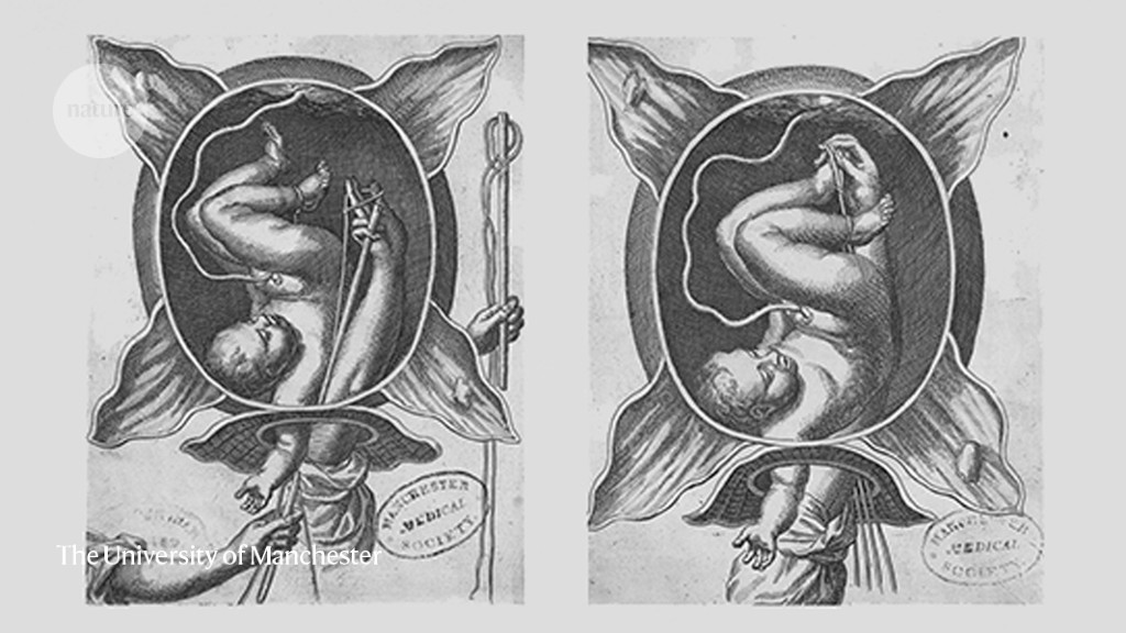 How sketches of the womb have empowered and oppressed women over the ages
