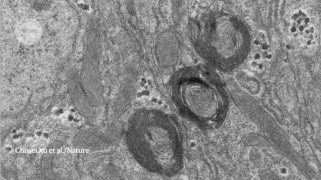 New cellular ‘organelle’ discovered inside fruit fly intestines