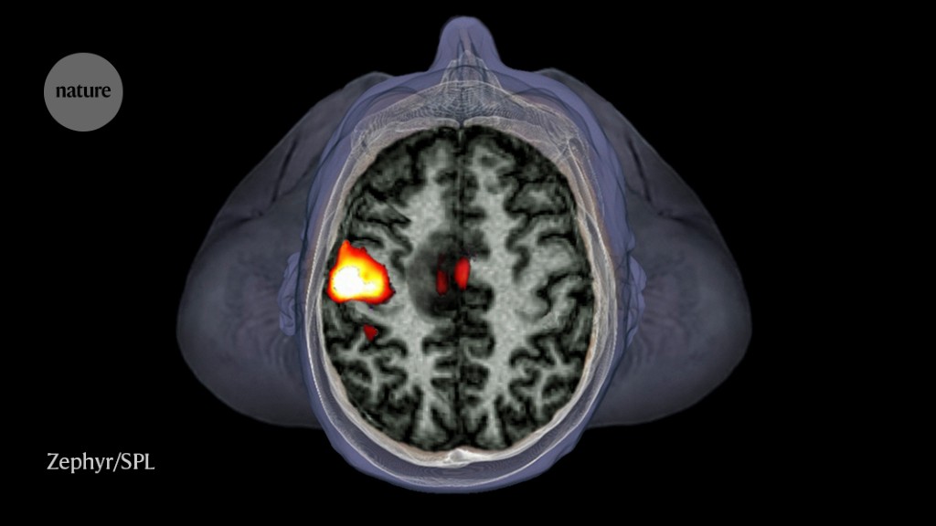 Brain imaging: fMRI advances make scans sharper and faster