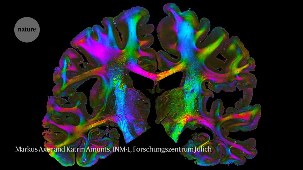 Europe spent €600 million to recreate the human brain in a computer. How did it go?