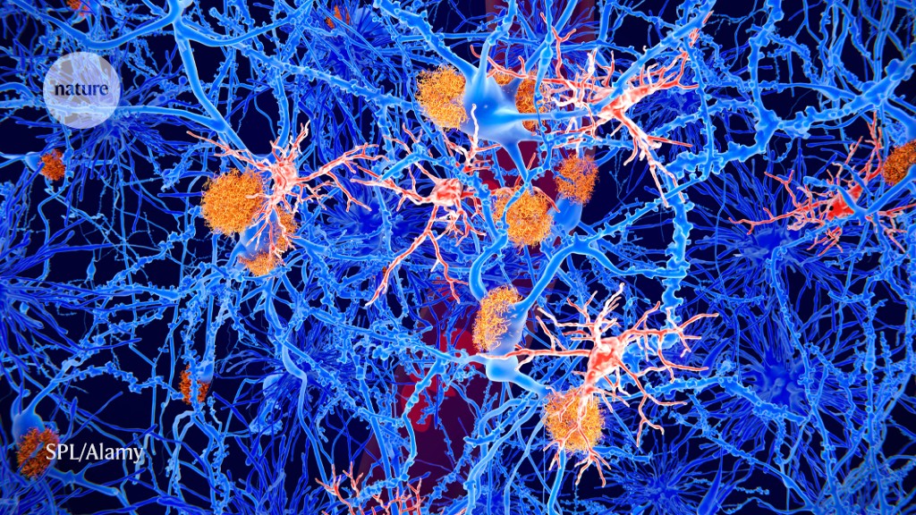 The brain cells linked to protection against dementia