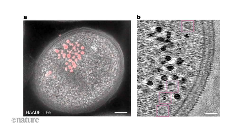 This is a summary of: Pi, H. et al. Clostridioides difficile ferrosome organelles combat nutritional immunity. Nature https://doi.org/10.1038/s41586-0