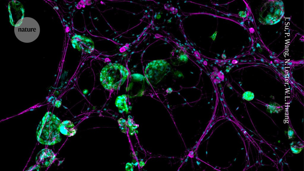 How cancer hijacks the nervous system to grow and spread