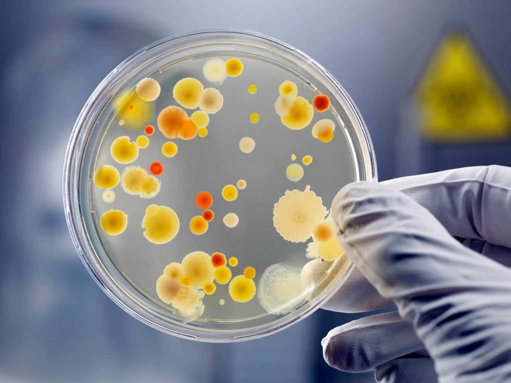 mycoplasma contamination in cell culture