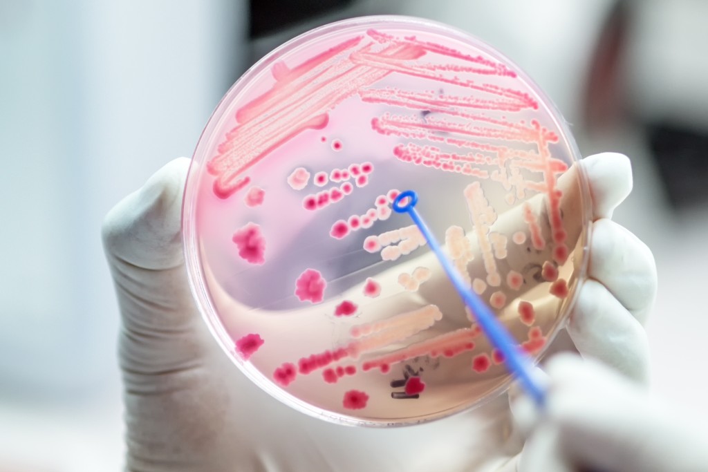 Diagnosing bacterial infections using smartphones