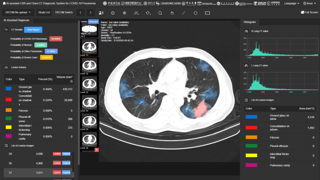 Leveraging Big Data And AI In Medical Diagnosis