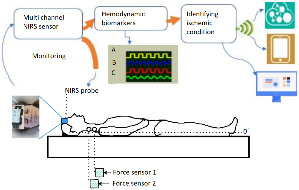 Device detects early signs of stroke