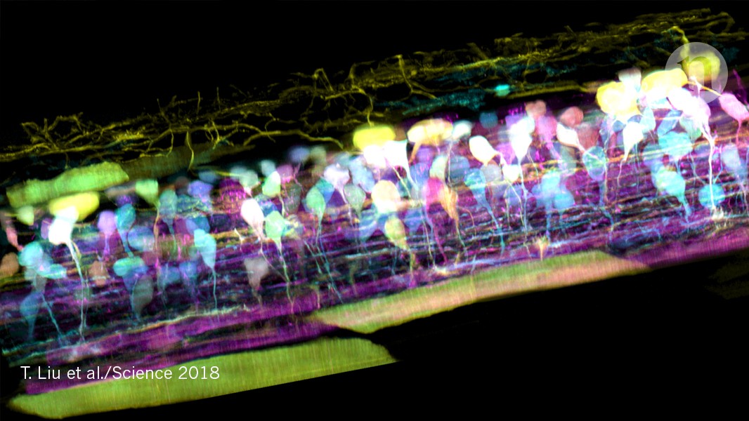 Cutting-edge microscope spies on living cells inside the body