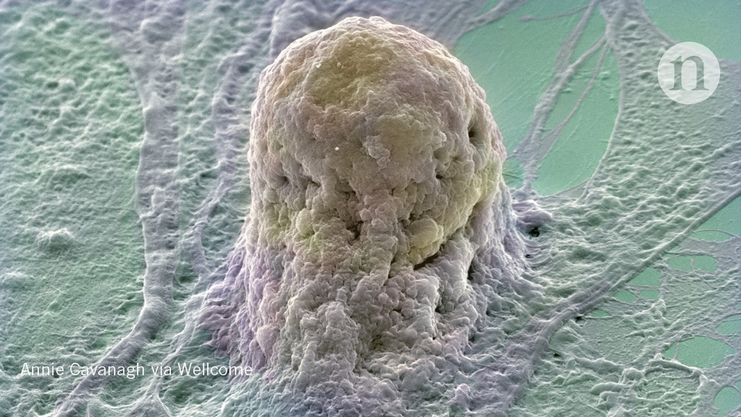 CRISPR gene editing produces unwanted DNA deletions