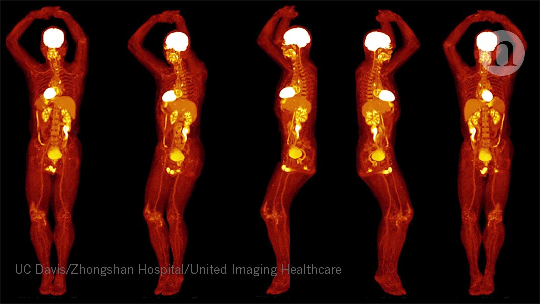 Whole-body PET scanner produces 3D images in seconds | Nature
