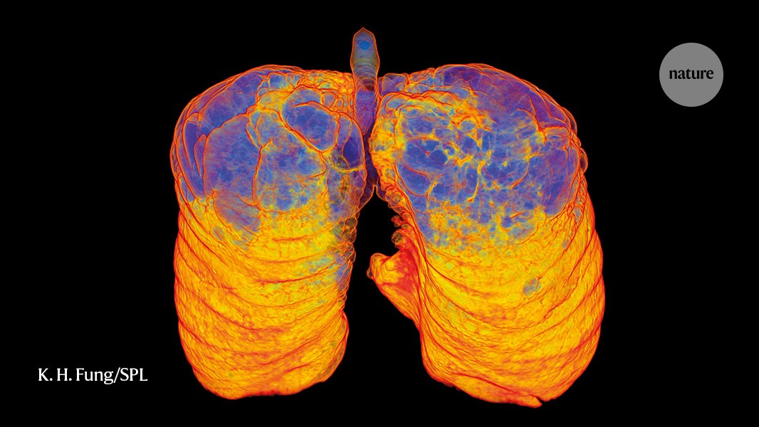 Research round-up: COPD