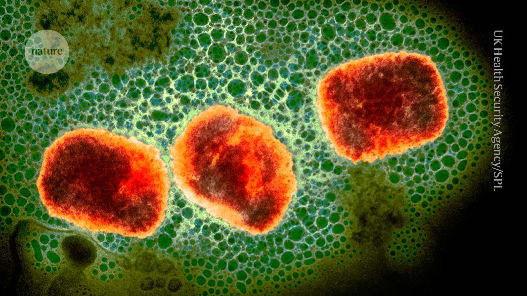 Monkeypox virus: dangerous strain gains ability to spread through sex, new data suggest