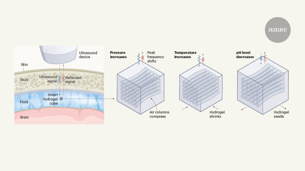 Brain fluid probed by ultrasound using squishy cubes