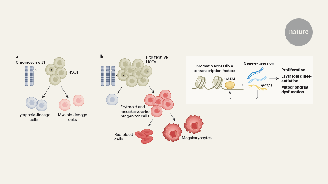 Childhood leukaemia in Down’s syndrome primed by blood-cell bias