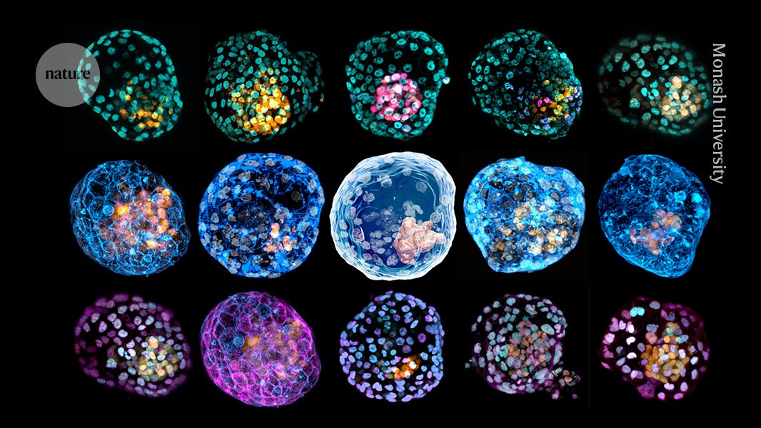 Human embryo models are getting more realistic — raising ethical questions