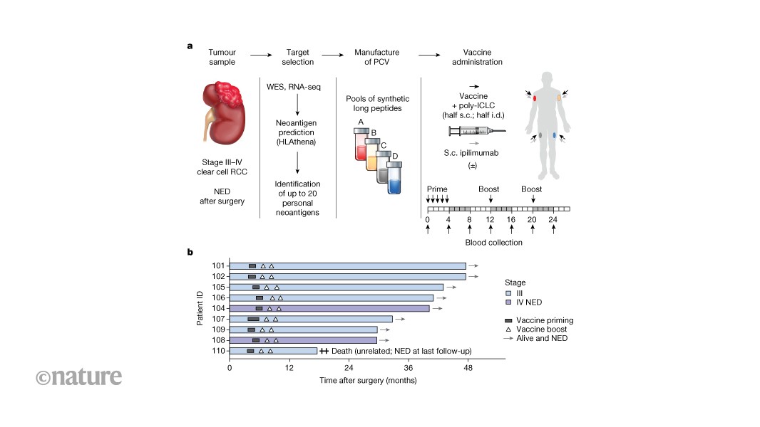 A personalized cancer vaccine to prevent the return of high-risk kidney cancer