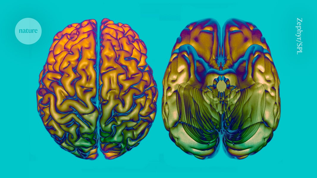 How fast your brain ages is affected by these 64 genes