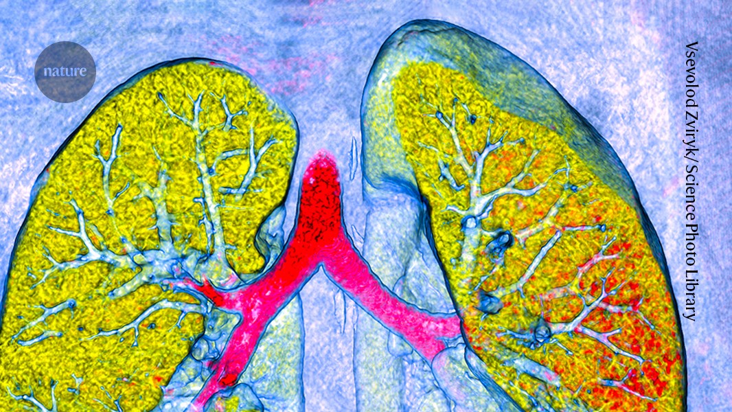 Technologies to give a clearer view of the lungs