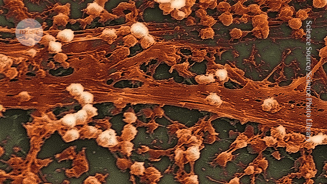 How ageing harms the body's response to raging infection