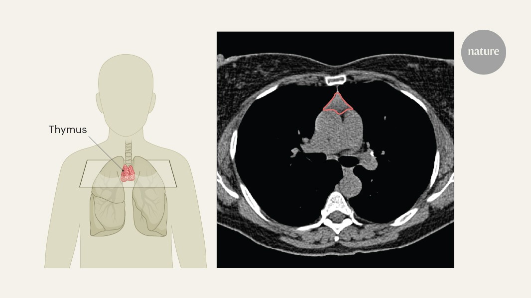 Being and immunotherapy effectiveness