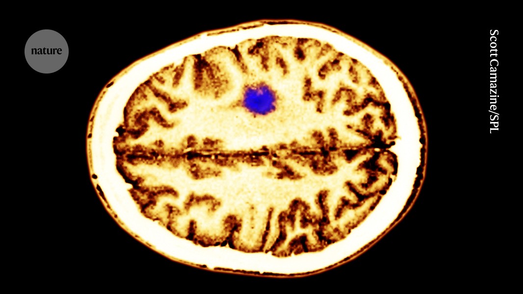 The neurons that can put a brake on a nervous-system cancer