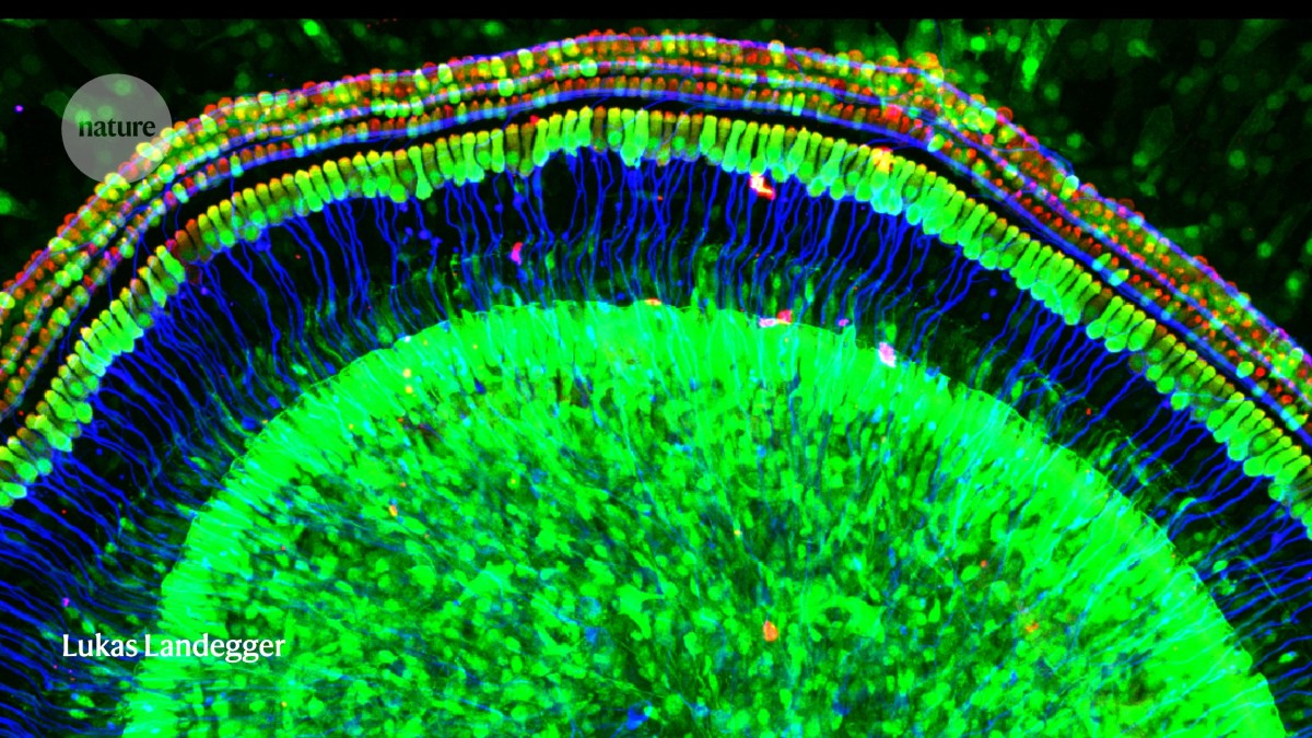 Restoring hearing in people with a rare form of deafness