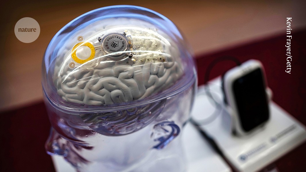 ‘Çoxfunksiyalı’ beyin implantı nitq və jestləri real vaxtda tərcümə edir