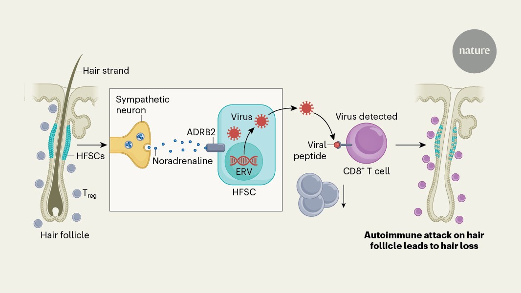 Nerve activity initiates autoimmune hair loss