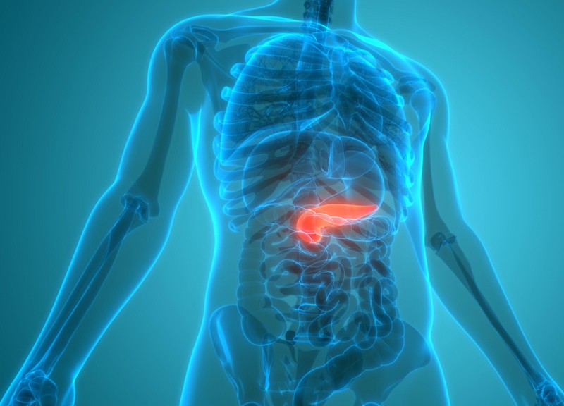 A surprising abundance of pancreatic pre-cancers