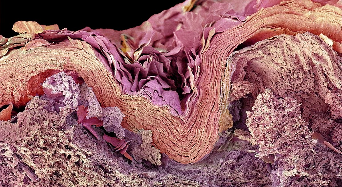 Skin Microfiber Exploring electrospun microfibres to bolster skin hydration