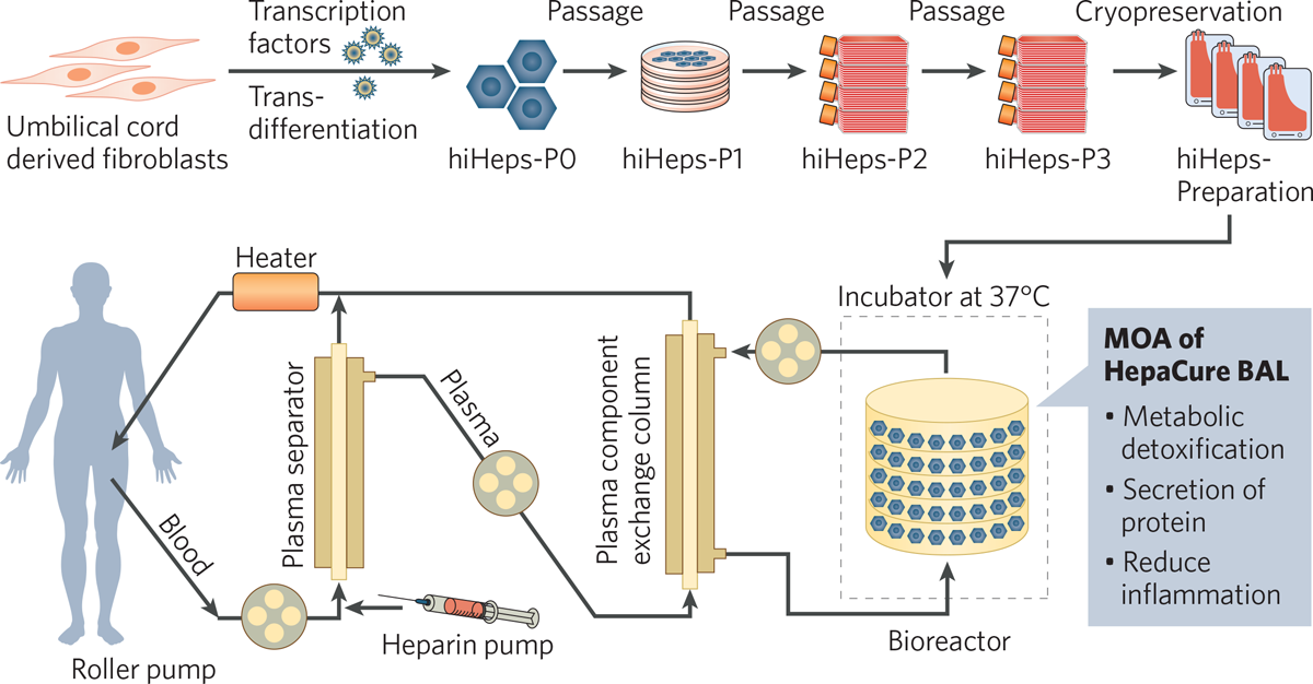 Bionic Liver Trials of first-in-class bioartificial liver indicate potential