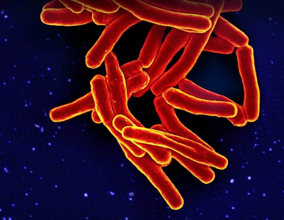 New ways to tackle multi-drug resistant TB