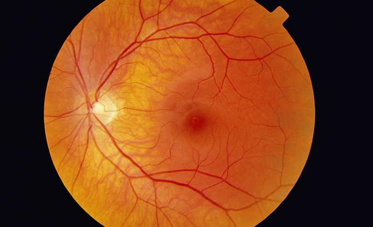 Picture of retina