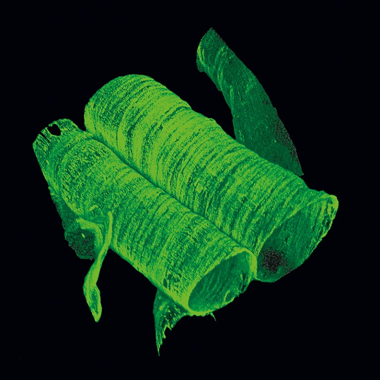 Microscope image of dystrophin (green) in the membrane of muscle cells.