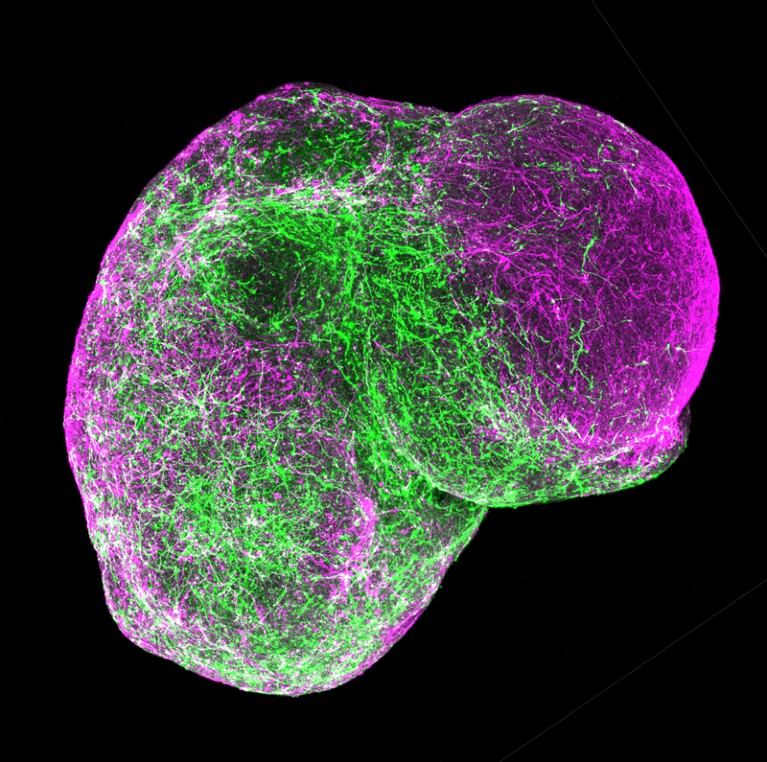 Two forebrain organoids that have been assembled