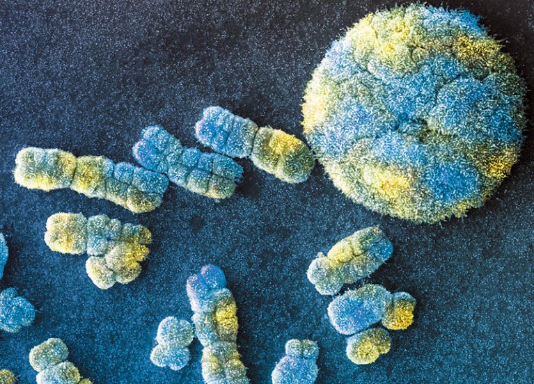 SEM image of human chromosomes and a nucleus.