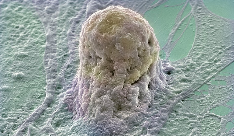 SEM image of a single human embryonic stem cell (gold) growing on a layer of supporting fibroblast cells (purple and green).
