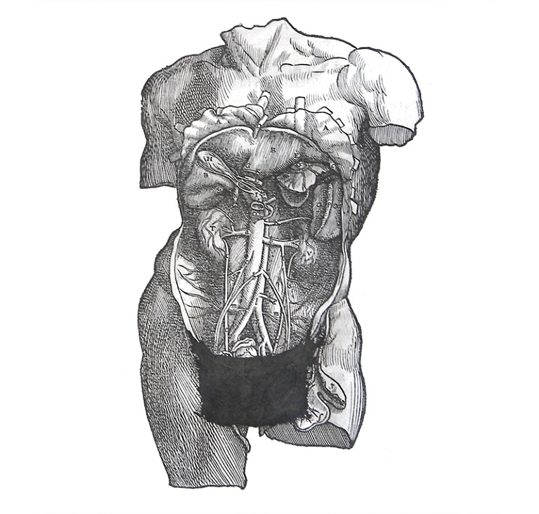 A censored male torso illustration with a drawn on ‘modesty apron’ covering the genital area.