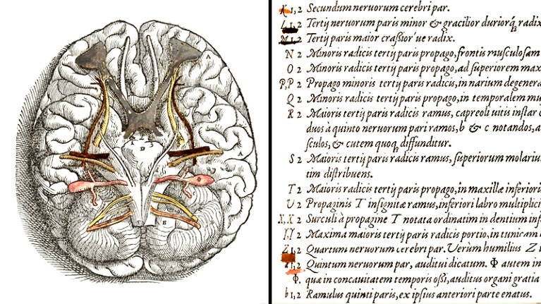 Left - Brain illustration with pink, yellow, brown and grey areas painted in. Right: Colour coded corresponding list.