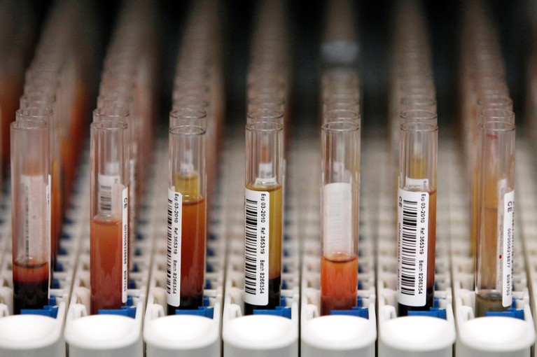 Blod samples at the UK Biobank