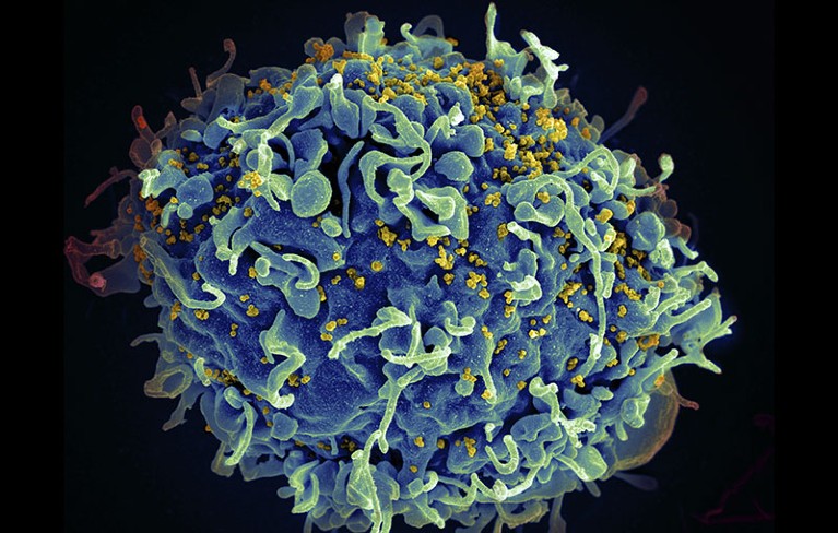 T cell under attack by HIV