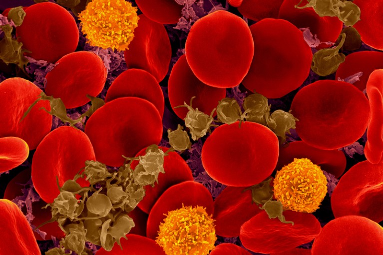 Micrograph of red blood cells, 3 T-lymphocytes and activated platelets
