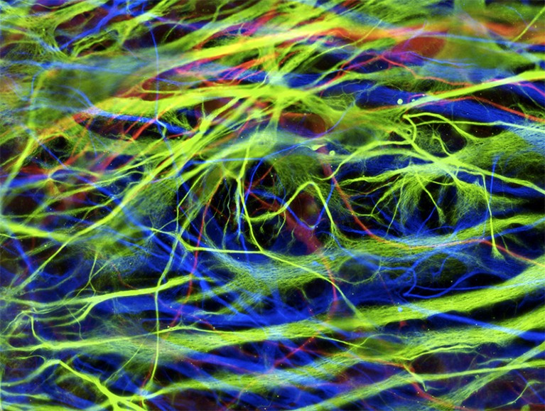 Colourful fluorescent light micrograph of astrocyte brain cells derived from neural stem cells